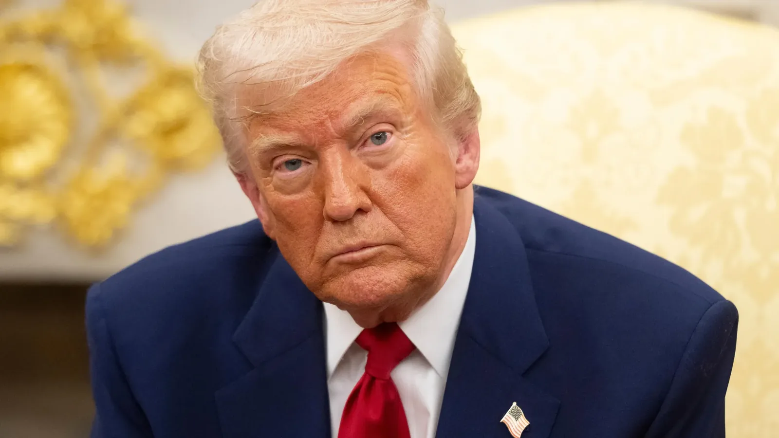 Trump’s Leg Swelling: CVI Risk Alert for Millions